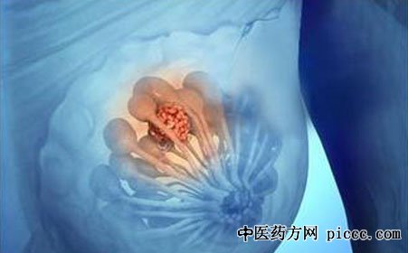健康之路20191121:张瑾,乳房查看莫忽视,乳腺癌,乳房肿块的自检方法