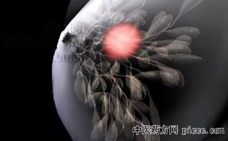 健康之路20191121:张瑾,乳房查看莫忽视,乳腺癌,乳房肿块的自检方法