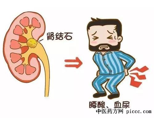 养生堂20191127:徐涛,胡浩,肾在哪里,什么样的排石方法最科学