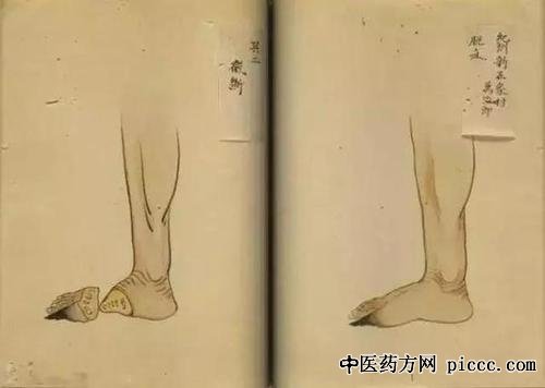 健康之路20191213:刘继前,脱疽是什么病,腿麻,腿凉,腿痛怎么办