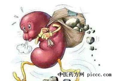 健康之路20191216:李建兴,长了结石怎么办,肾结石哪里来,高尿酸症