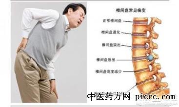健康之路20200114:吴浩,腰间盘突出怎么自我判定,有什么症状