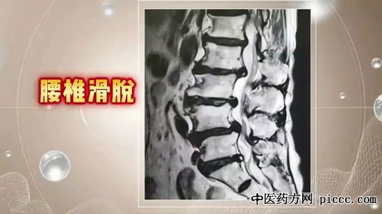 ÑÏñ´,¼¡ÈâµÄ¶ÍÁ¶·½·¨,¼¡ÈâºÍ¹Ç÷ÀµÄ¹ØÏµ