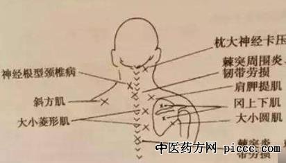 ����֮·20200313:������,�񾭸��;�׵�������Ʒ���,�������Բ�