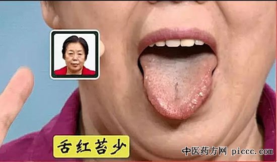 健康之路20200316:倪诚,蜂蜜银耳百合,阴虚体质调养方,三阴交