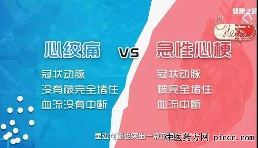 健康之路20200420:舒畅,别让斑块要了命,颈动脉狭窄的测试与治疗