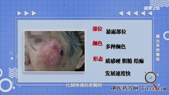 ����֮·20200525:������,ɹ�����İ�֢,�չ��Խǻ�,����ƺְ�