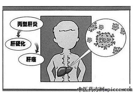 健康之路20200629:贾继东,导致肝癌的元凶是什么,莫让肝炎变肝癌