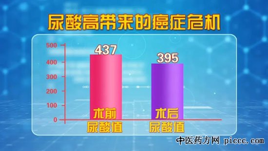 养生堂20200709:马潞林,高尿酸引发的癌症危机,尿酸,痛风