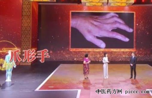 养生堂20200917:张黎,杞玉山药代茶饮,参精山药粥,手脚血糖警报