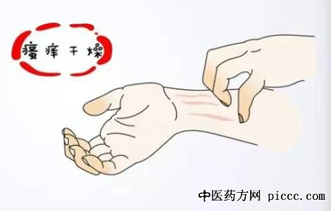 养生堂20200924:晋红中,皮肤瘙痒,糖尿病形成的皮肤瘙痒