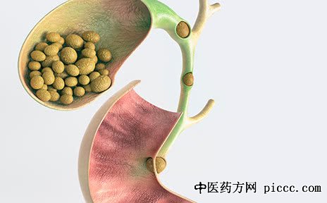 ����֮·20210119:����,���õ���ʯ������,����ʯ���ת���ɰ�֢��