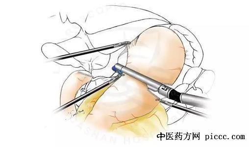 20210422:ѧ,θ,ήθ,ҽҽΰ