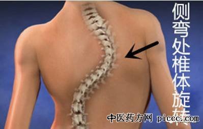 ����֮·20210428:����,����Ӽ�����״,Զ�������꼹������