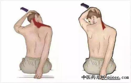 健康之路20210520:矫玮,专家教你如何正确锻炼肩颈,颈部巧训练