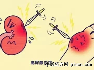 养生堂20210524:王海隆,高尿酸并不等于痛风,嘌呤,尿酸痛风