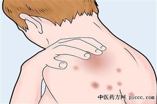 ����֮·20210525:�Ž���,�Ĳ����İ�֢��м��,ţƤѢ,��м������