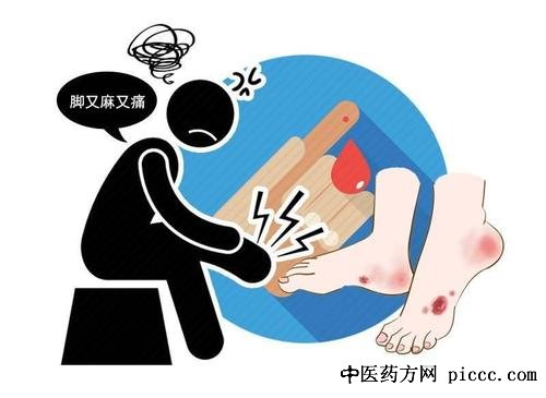 健康之路20210527:张明珠,习惯导致跟腱损伤,运动不妥脚遭殃