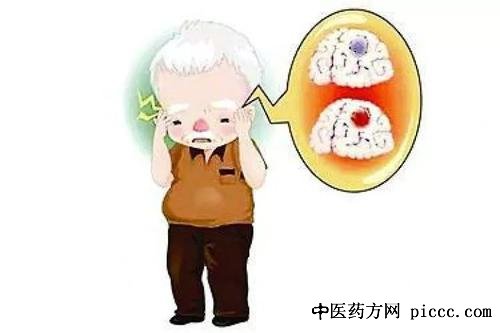 健康之路20210530:郝峻巍,脑卒中脑中风,预防脑卒中的发生