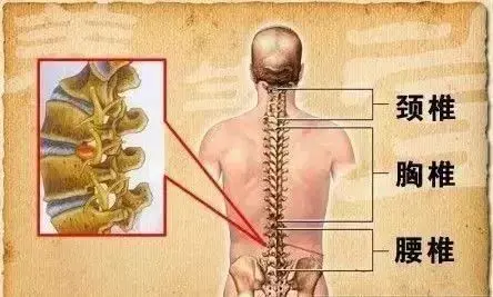 养生堂20210723:保护椎间盘,腰部肌肉和韧带,解救被绑架的神经