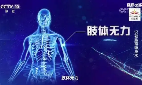 健康之路20210810:顾建文,脑瘤,伪装在其他疾病背后的脑膜瘤