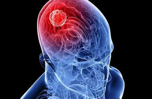 健康之路20210907:万经海,脑瘤的症状与治疗,脑瘤都需求医治吗