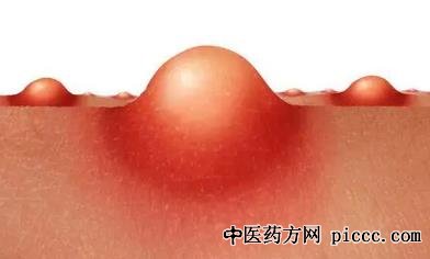 健康之路20211029:余胜吉,小疙瘩是瘤吗,脂肪瘤,纤维瘤,腱鞘囊肿