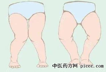 养生堂20211102:藏磊,郑寅峰,自我诊断有没有罗圈腿,护膝秘籍