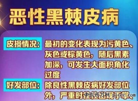 养生堂20211106:高艳青,黑棘皮病,皮肤上反常的变色识肿瘤,皮肌炎