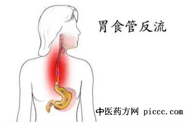 养生堂20211116:李印,康晓征,胃食管反流,反流性胸痛,反流哮喘