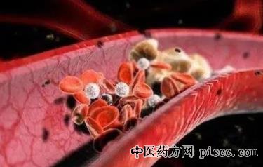 养生堂20211119:樊碧发,糖尿病,糖尿病并发症,糖尿病血管病变