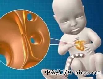 养生堂20211228:马为,郑博,卵圆孔未闭的症状与治疗,偏头痛脑梗