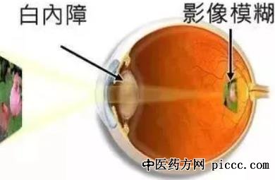 健康之路20220112:白内障,青光眼,眼底病,杨松霖,聂洪平,潘英姿