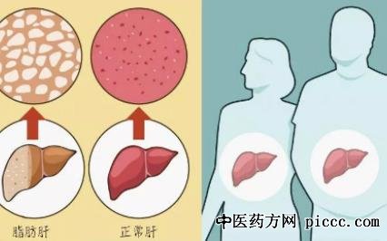健康之路20220113:脂肪肝会引发慢病,免疫力需提高吗,发烧老不退
