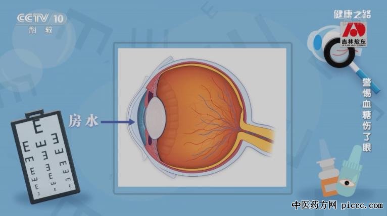 健康之路20220220:刘月明,测试预测糖尿病眼病风险到底有多大