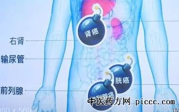 健康之路20220225:杜鹏,盛锡楠,肾癌,前列腺癌,膀胱癌不可怕