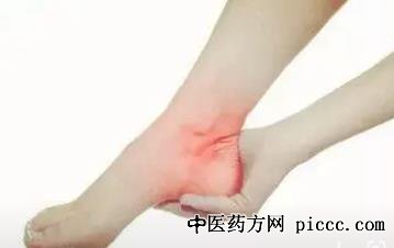 养生堂20220407:足跟痛,中医透皮吸收法,中医透法让骨重生