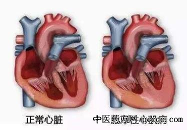 养生堂20220414:李海洋,心肌水肿,血管弥漫性斑块,段小春