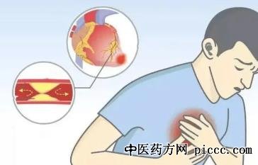 养生堂20220602:心梗如何自救,杨进刚,心梗盯上正常人,心梗危险