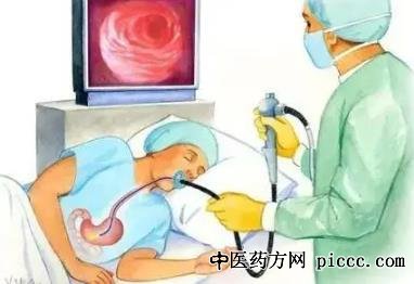 健康之路20220608:田雨,胃癌,确诊胃癌最有效的手段,胃镜检查