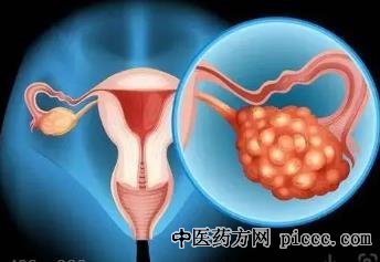 健康之路20220712:王建六,子宫的预警信号,子宫内膜癌三联征