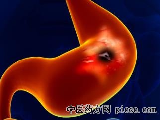 养生堂20220713:王贵齐,胃镜胃炎,你离胃癌有多远,肠息肉,胃息肉