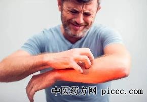 养生堂20220721:皮肤瘙痒,张建中,皮肤瘙痒背后的疾病,干燥瘙痒