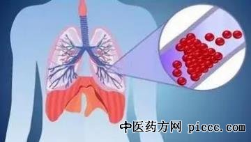 健康之路20220823:血栓堵塞肺动脉,血栓剥脱,深低温停循环技术