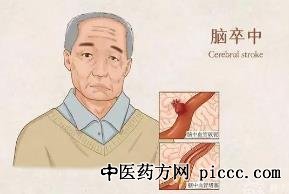 养生堂20220829:赵瑞珍,一叩降压法,醒脑开窍防中风,降压奇穴