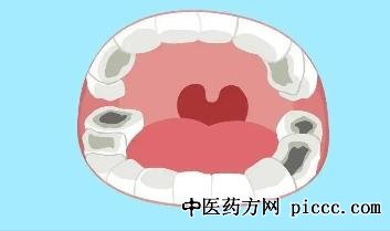 健康之路20220922:刘云松,乳牙有龋齿用不用治,邹晓英,吕珑薇