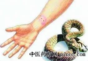 健康之路20221017:被蜜蜂哲伤后要将刺拔出吗,蛇咬伤后如何处理