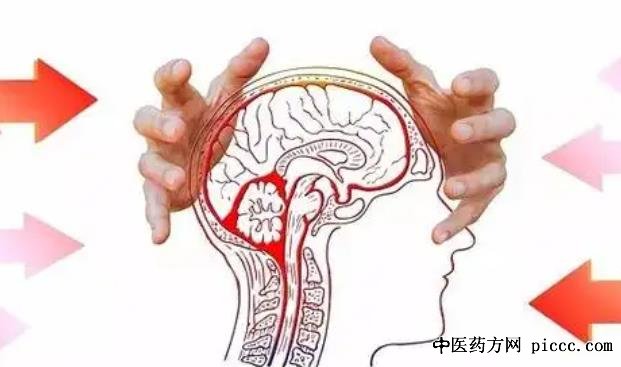 健康之路20221024:张鸿祺,人过四十要给大脑体检,脑血管畸形