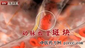 ½¡¿µÖ®Â·20221128:Ò¶Ö¾¶«,¾±²¿Óа߿éСÐÄÄÔ×äÖÐ,·®Ñ§Ç¿,ÕçÑÅÄÏ