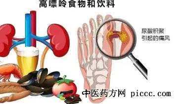 健康之路20221215:张学武,怎样避免痛风发作,痛风关节炎